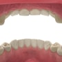 Effective Package for Dental Crown in Medellin, Colombia thumbnail