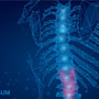 Exclusive Treatment Package for Spinal Stenosis in Puerto Vallarta, Mexico thumbnail