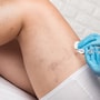 Permanent Spider Vein Removal in Costa Rica: Affordable, Effective, and Expert Care thumbnail