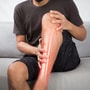 Stem Cell Therapy for Bone Fractures in Santo Domingo, Dominican Republic thumbnail