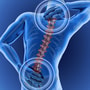 Cell Therapy for Neck & Back in Colombia — Packages Starting at $4,500 thumbnail