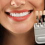 Relooking du sourire à Istanbul - Sourire hollywoodien, implants, couronnes à Istanbul thumbnail