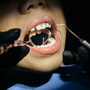 Thorough Dental Check up Package in Seoul thumbnail