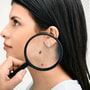 TILs Therapy Package for Skin Cancer in China by Beijing Bioocus Medical Group thumbnail