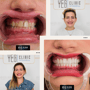 Hollywood Smile thumbnail