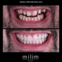 Full Mouth - Essential thumbnail