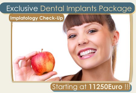 Best Dental implants in Greece Athens