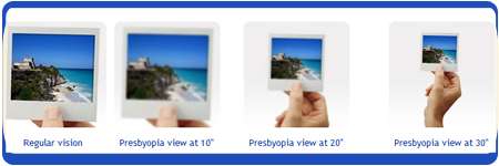 Presbyopia Example Presbyopia Example