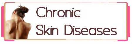Chronic Skin Diseases Banner