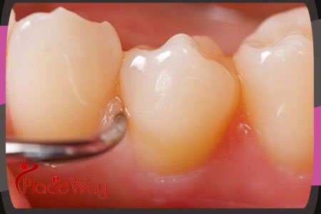 Root Treatment in Izmir Turkey Root Treatment in Izmir Turkey