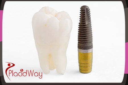 Dental Implants in Turkey
