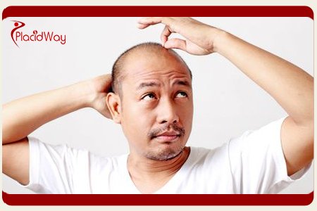 Hair Restoration Turkey