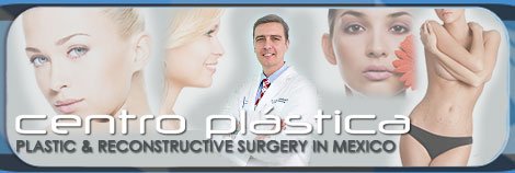 Tummy Tuck Surgery & Mini Liposuction at Centro Plastica Mexico Tummy Tuck Surgery & Mini Liposuction at Centro Plastica Mexico