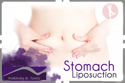 Stomach Liposuction in Croatia