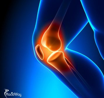 Knee Replacement Surgery India