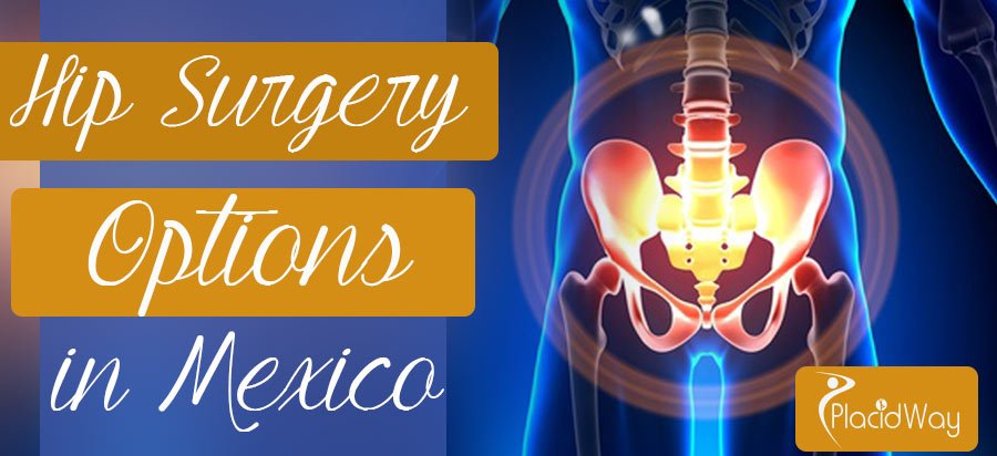 Hip replacement surgery in Mexico