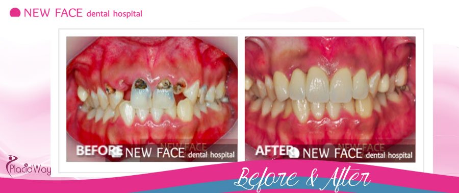 Restorative Dentistry South Korea