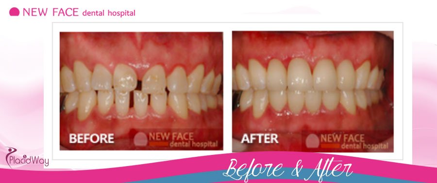 Smile Restoration Dental Hospital Asia