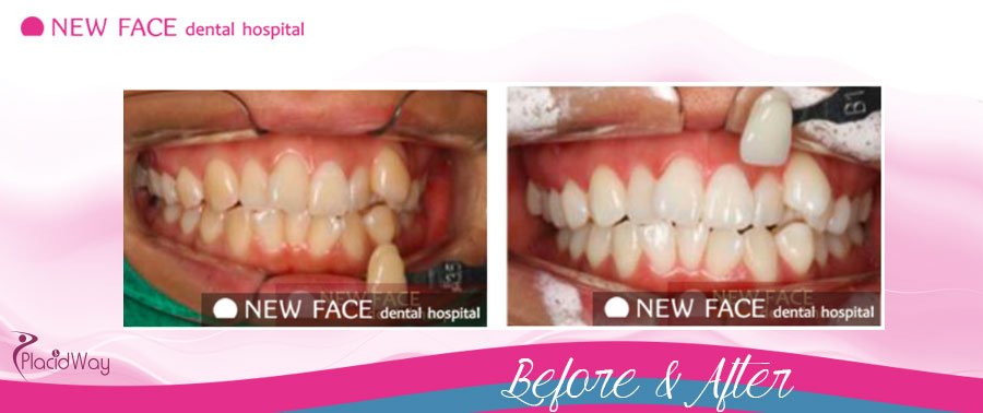 Testimonial After Restorative Dentistry Asia