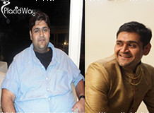 Obesity Surgery in India, Before and After Pictures