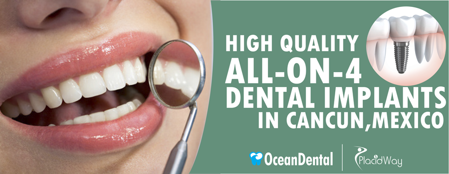 high quality all on 4 dental implants in mexico dental implants in mexico