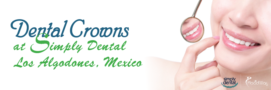Dental Crowns in Los Algodones, Mexico