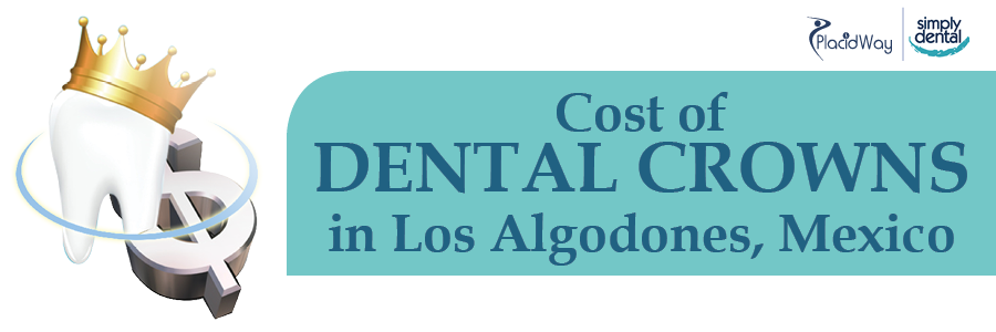 Dental Crown Cost in Mexico
