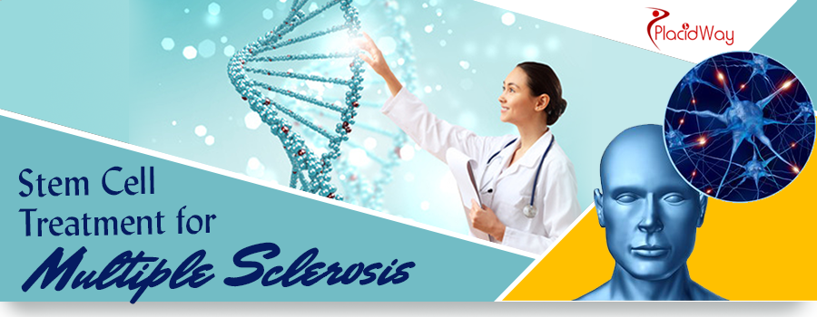 Tratamiento con células madre para la esclerosis múltiple