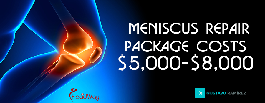 Price Package of Meniscus Repair in Jalisco, Mexico