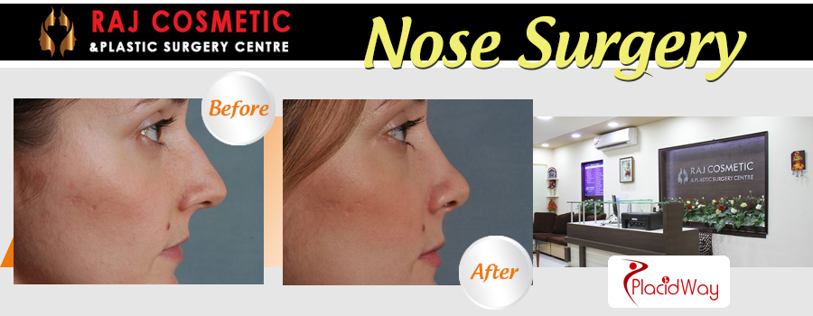 Before and After Images Nose Surgery India