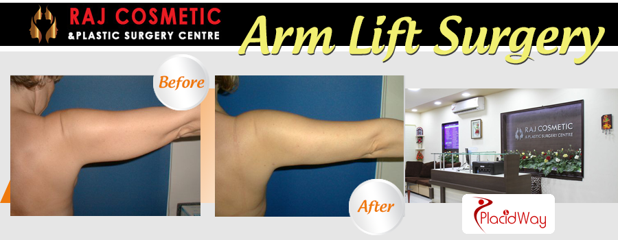 Before and After Images Arm Lift Surgery India