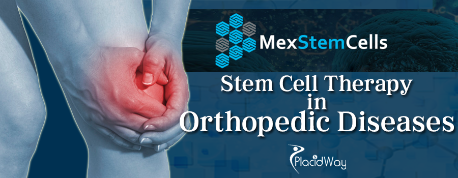 Stem Cell Therapy for Orthopedic Diseases - Osteoarthritis in Mexico