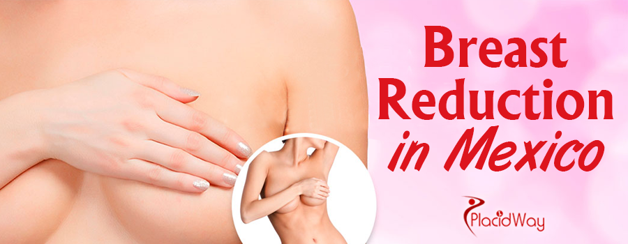 Breast Reduction Surgery Packages in Mexico