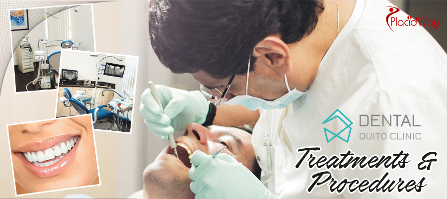 Dental Implants, Dental Crowns, Cosmetic Dentistry in Quito, Ecuador