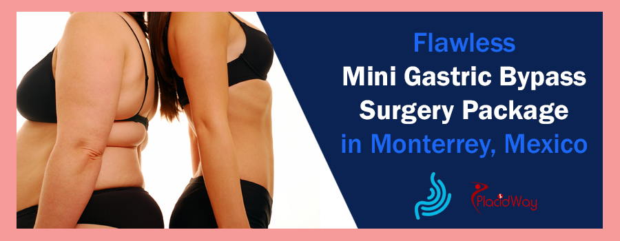 Mini Gastric Bypass Mexico