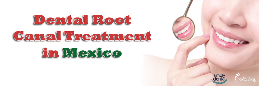 Dental Root Canal in Mexico