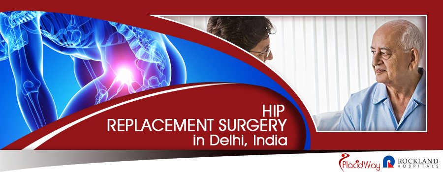 Hip Replacement Package in Delhi