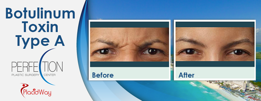 Before and After Cosmetic Procedure in Cancun Mexico