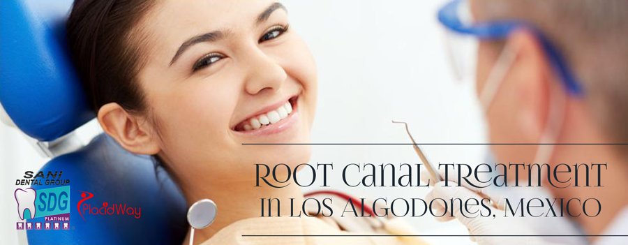 Root Canal Treatment in Los Algodones Mexico