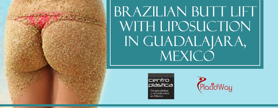 Brazilian Butt Lift with Liposuction in Guadalajara Mexico