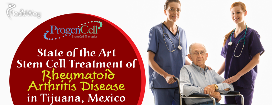 Stem Cell Therapy for Rheumatoid Arthritis in Tijuana Mexico
