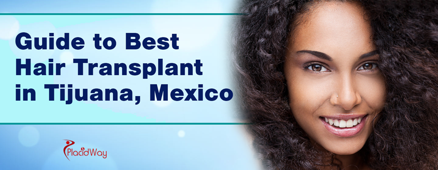 Guide To Best Hair Transplant In Tijuana Mexico