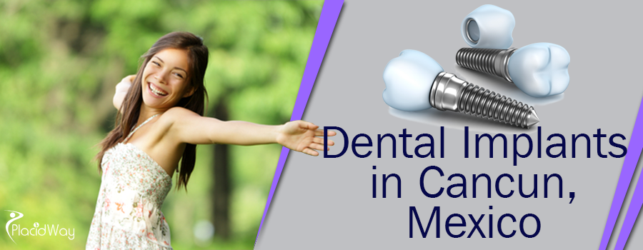 Dental Implants in Cancun, Mexico