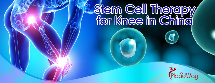 Stem Cell Therapy for Knee in China