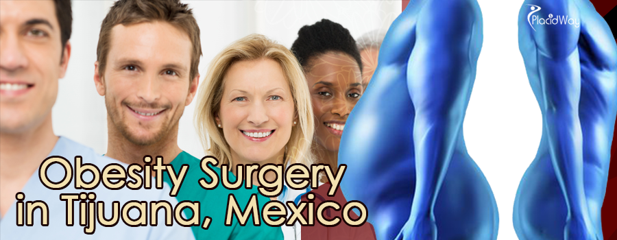 Obesity Surgery in Tijuana, Mexico