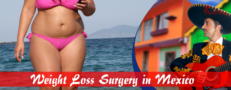 Weight Loss Surgery in Mexico