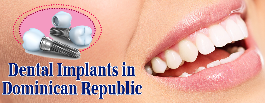 Cheap Dental Implants in the Dominican Republic