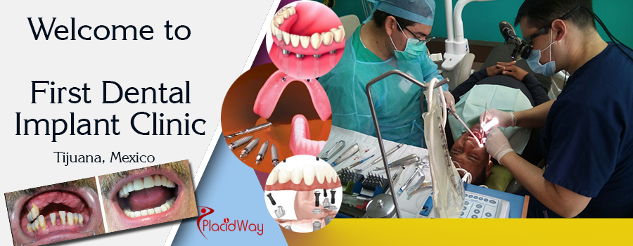 First Dental Implant Clinic, Orthodontics and Smile Correction, Tijuana, Mexico