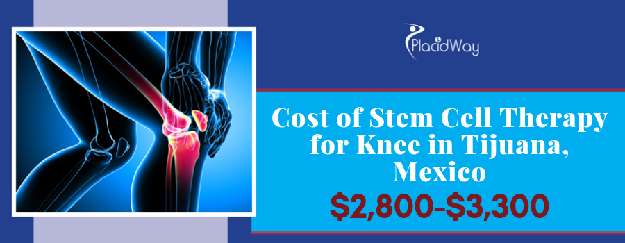 Cost Package for Stem Cell Therapy for Knee in Tijuana, Mexico