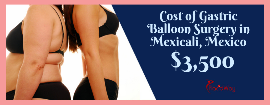 Cost of Gastric Balloon Surgery in Mexicali, Mexico